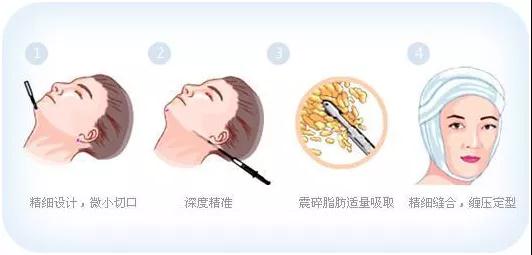 十大足球赌注软件排行榜